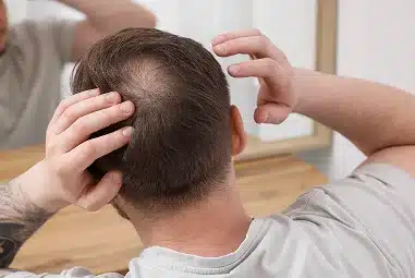 Alopecia Doctor | Dr. Katherine Rodriguez|Home