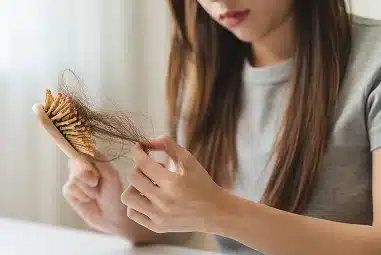 Alopecia Doctor | Dr. Katherine Rodriguez|Home
